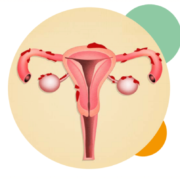 endometriose doença da mulher moderna - Clinifert - /clinica de fertilização in vitro florianópolis
