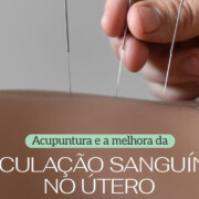 Acupuntura e a melhora da circulação sanguínea no útero - Clinifert Clinica Reproducao Humana Florianopolis