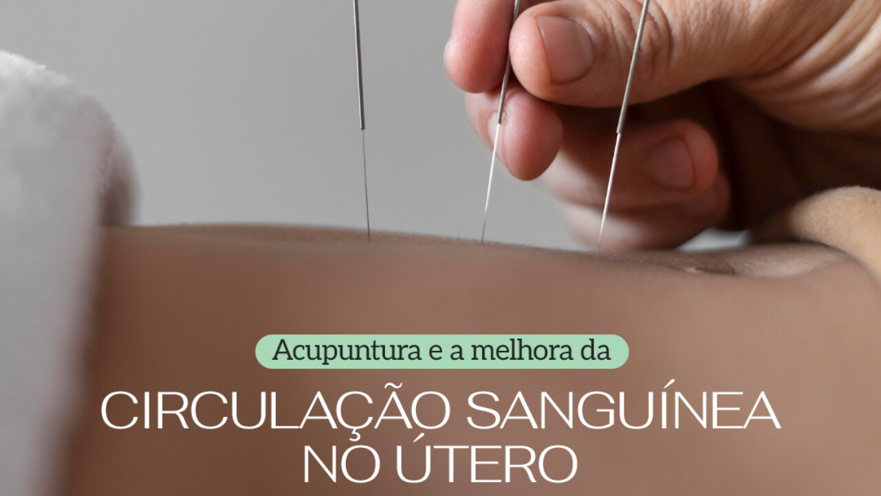 Acupuntura e a melhora da circulação sanguínea no útero - Clinifert Clinica Reproducao Humana Florianopolis