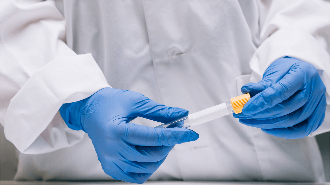 espermograma Florianópolis - Clinica de reprodução humana Clinifert